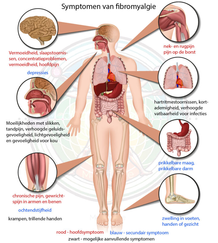 Fibromyalgie Modificare